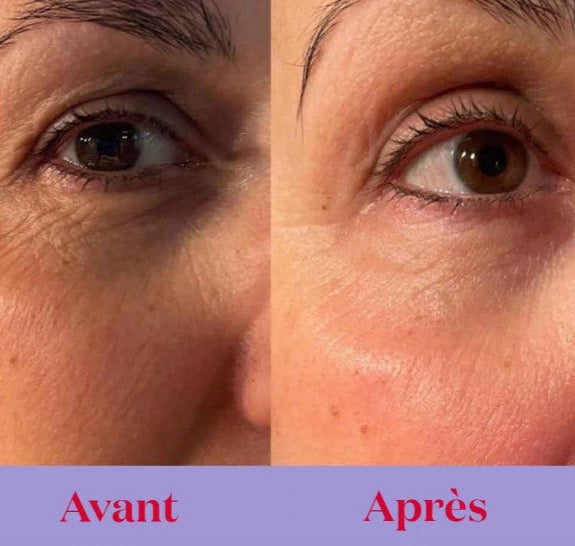 Masque anti cernes et poches, anti ridules de la marque Akane
